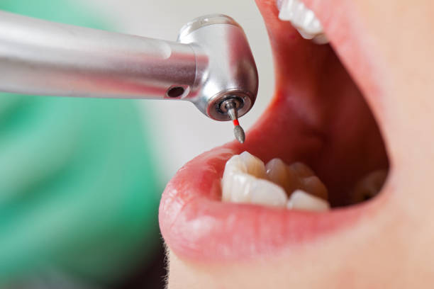 , TX Emergency Dental Service Company